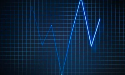Laravel Pulse Monitoring: Architecture, Implementation, and Performance Tuning